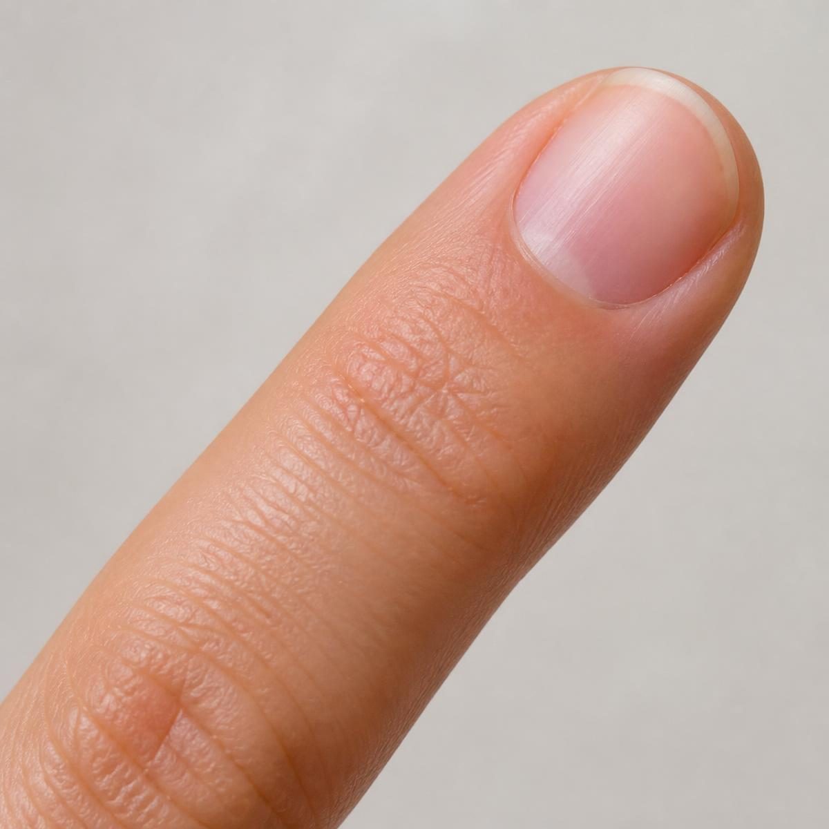 Photograph for the word „прст“ (finger, toe)