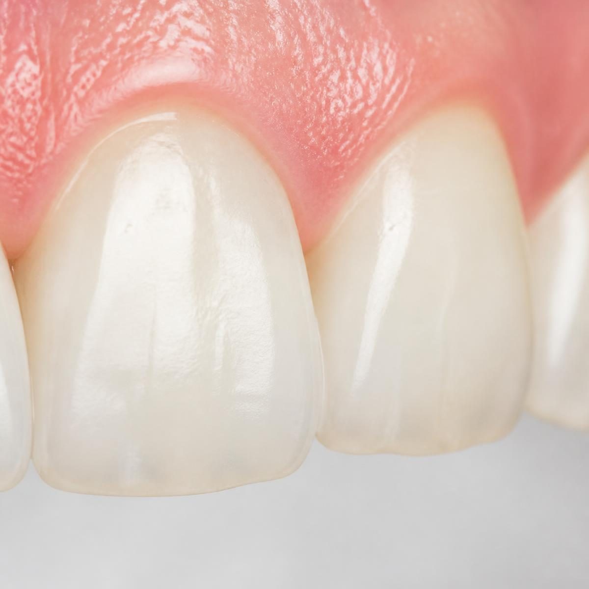 Photograph for the word „зуб“ (tooth)