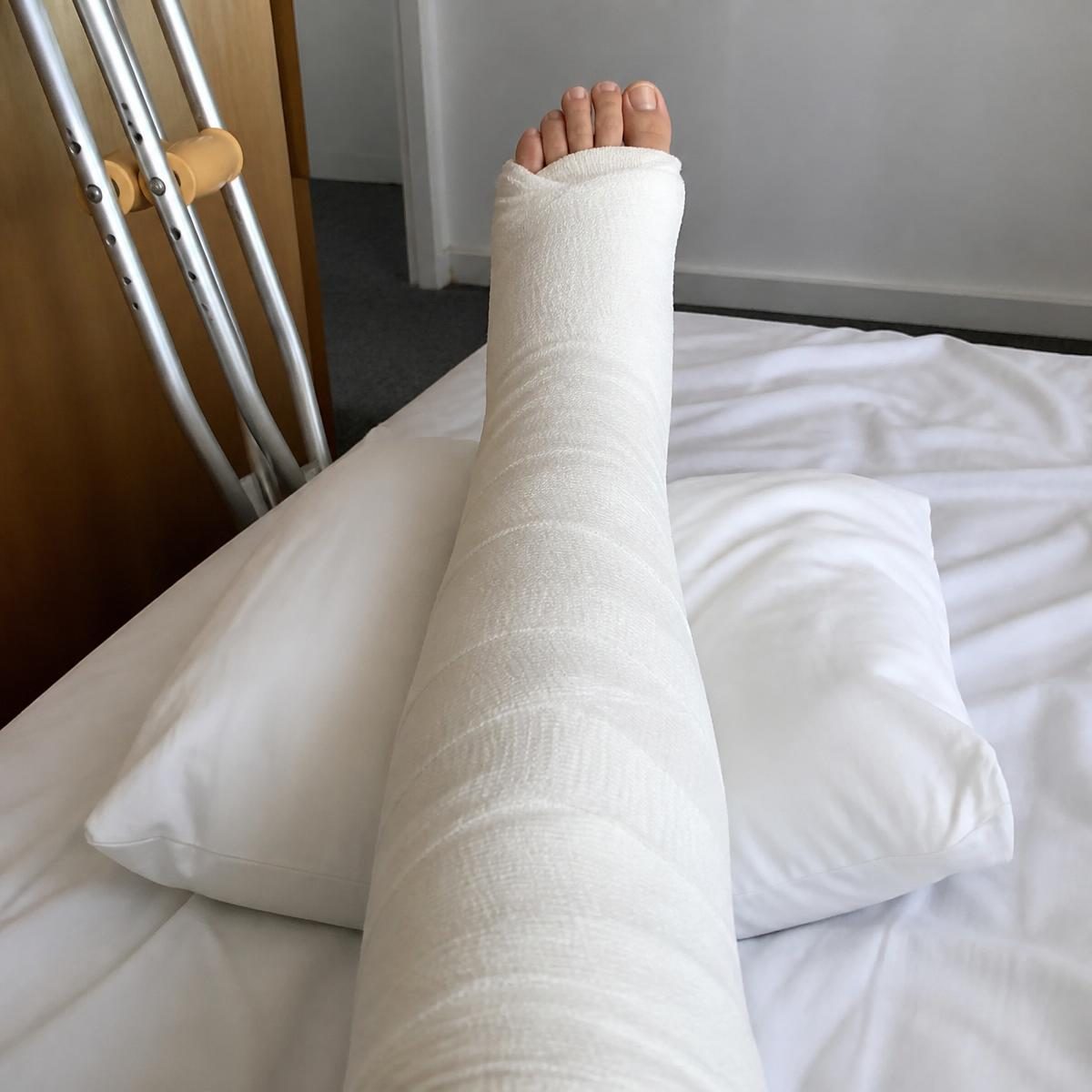 Photograph for the word „сломити“ (to break (e.g. a bone))